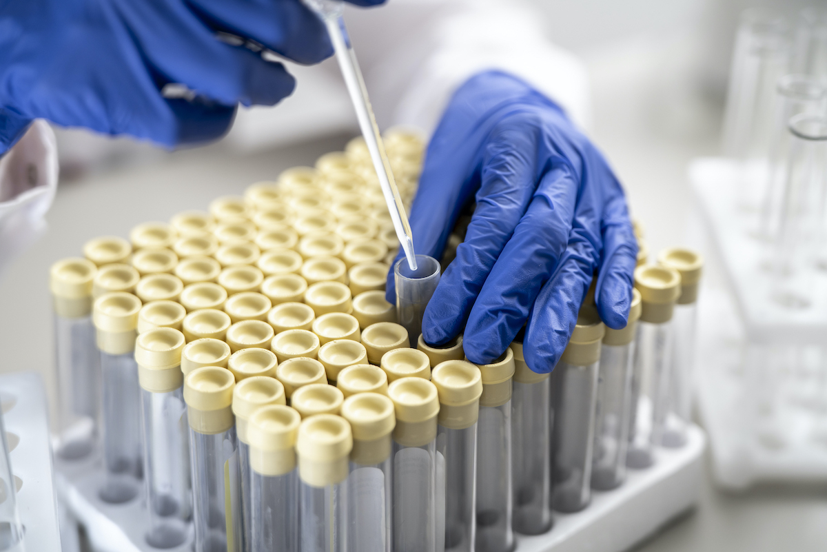 Analisis de metales pesados en agua potable y residual